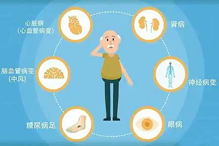 糖尿病慢性并发症及防治